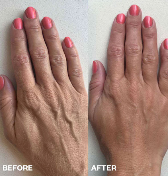 Side-by-side comparison of the back of a model's hand before and after using a Hand Wrinkle Patch