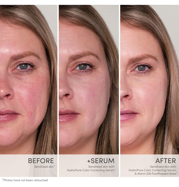 Unretouched side-by-side comparisons of a model's skin before and after using Jane Iredale HydroPure Color Correcting Serum to treat redness, and lastly with an application of PurePressed Base