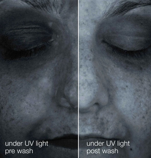 Side-by-side comparison of a model's face under UV light before and after using Dermalogica Oil to Foam Total Cleanser