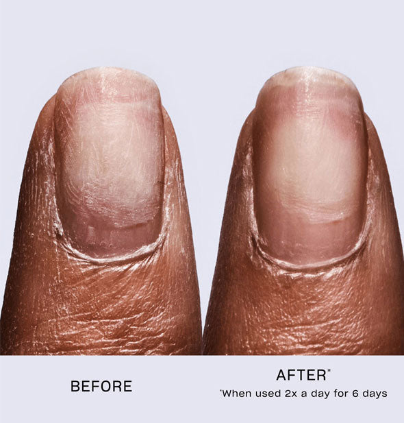 Side-by-side comparison of a model's fingernail before and after using OPI Repair Mode 2 times a day for 6 days