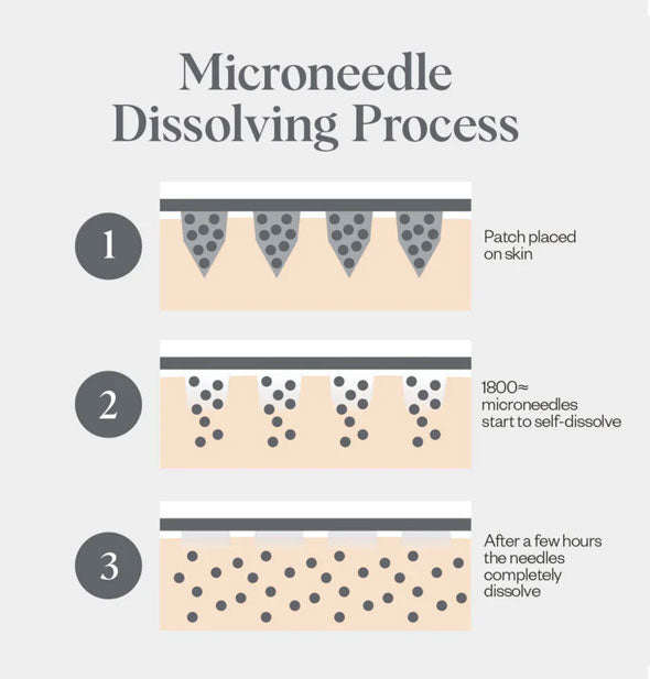 Three-part illustrated diagram of the Microneedle Dissolving Process of Wrinkles Schminkles Self-Dissolving Microneedle Patches works