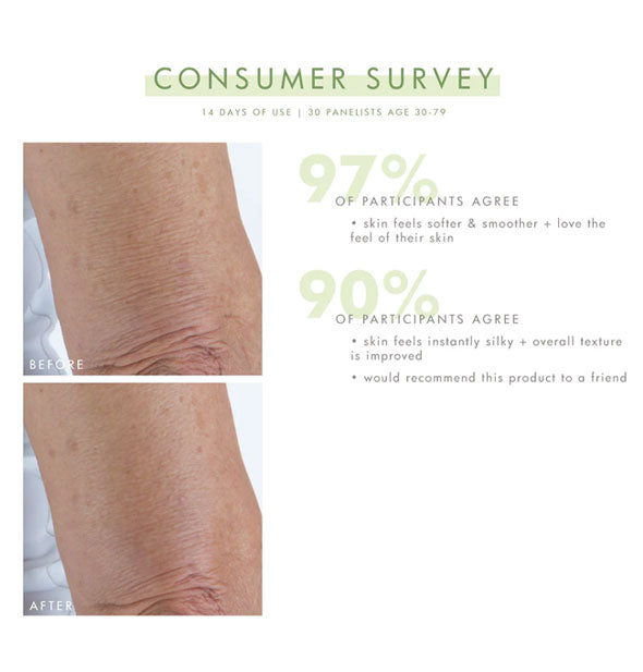 Consumer survey with before and after comparison photos after 14 days of use indicates 97% of participants agree skin feels softer and smoother and 90% agree skin feels instantly silky and overall texture is improved