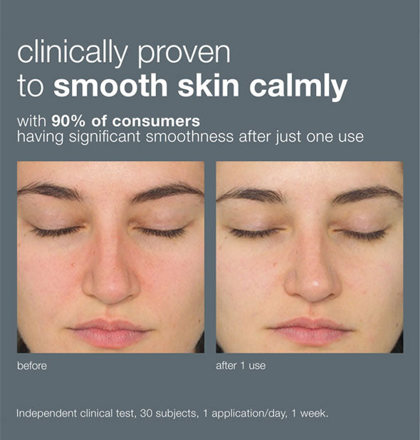 Before and after 1 use comparison of Dermalogica Daily Milkfoliant: "Clinically proven to smooth skin calmly with 90% of consumers having significant smoothness after just one use"
