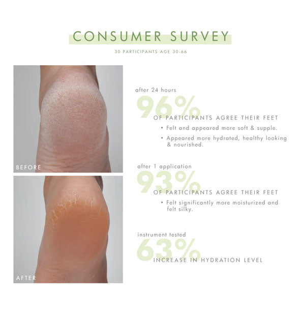 Consumer survey results of 30 participants age 30-66 states found that 96% of participants agree feet felt and appeared more soft. supple, hydrated, healthy-looking, and nourished after 24 hours; 93% felt significantly more moisturized and silky after 1 application; and 63% increased hydration level overall