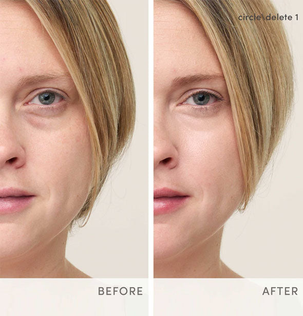 Model's under-eye area before and after applying Jane Iredale Circle\Delete Concealer