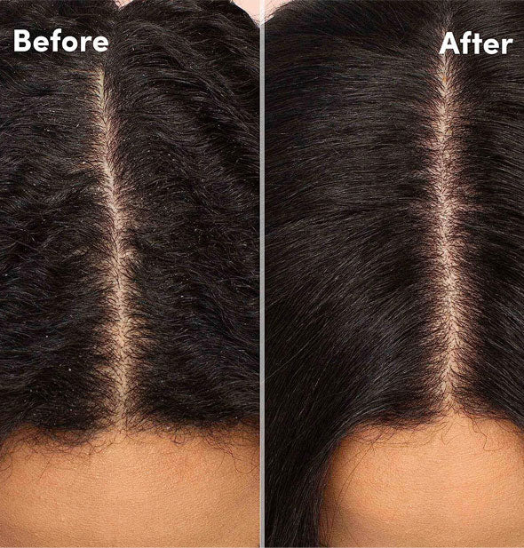 Side-by-side closeup comparison of a model's scalp before and after treating with Mizani Scalp Care Calming Scalp Lotion